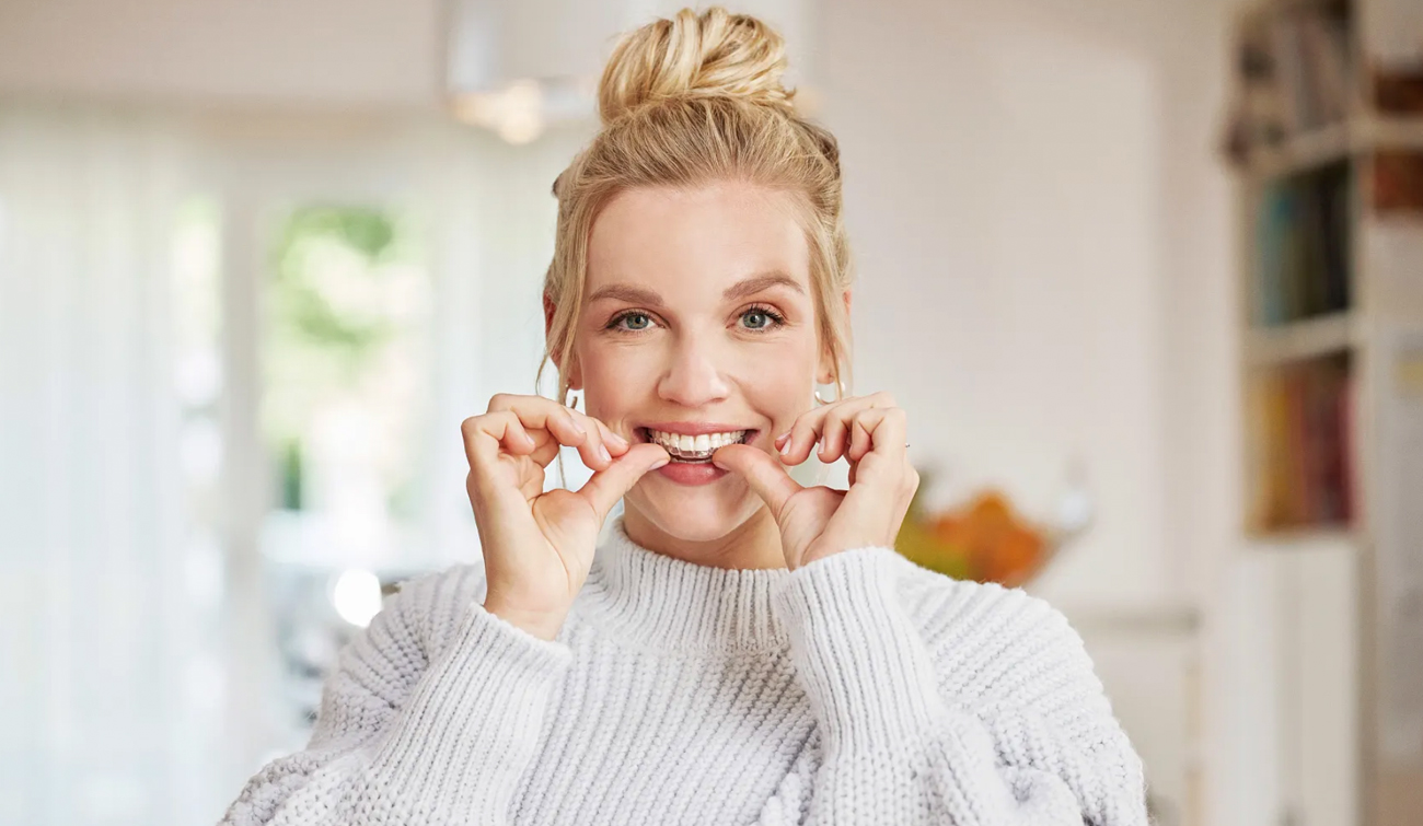 toppbanner_aligners_Spark